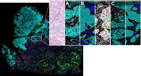AI-driven image analysis